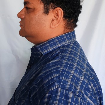 Left side Face